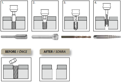 BRGBKT48-06 BOLT REMOVER KIT ( ATA Garryson ) - 2